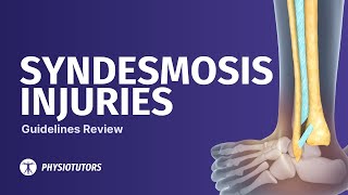 Ankle Syndesmosis Injury Guideline  SYNOPSIS [upl. by Enytnoel]