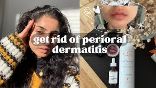 my perioral dermatitis journey  what actually worked what didnt natural healing and more [upl. by Qerat]