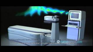 Customized wavefrontguided Treatments LASIK amp PRK Arabic [upl. by Bettencourt571]