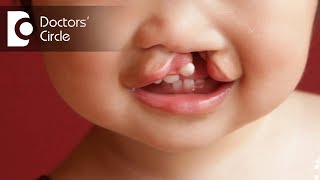 Surgeries for Cleft Lip amp Palate  Dr Srikanth V [upl. by Stichter]