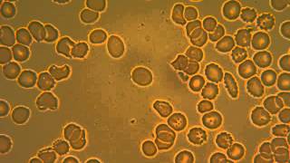 BACTERIAS EN SANGRE Y DENTRO DE ERITROCITOS SIN HEMOGLOBINA [upl. by Namwob]