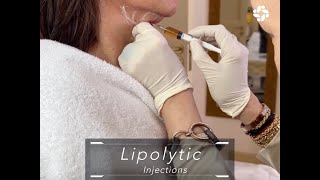 LIPOLYTIC INJECTIONS FOR FACIAL CONTOURING [upl. by Justinn]