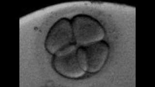 Rotation of the blastomeres at 4cells human embryoavi [upl. by Essenaj]