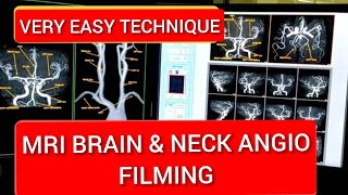 Brain and Neck Vessels MRI Angiography filming Protocol [upl. by Eiduam718]