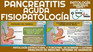 PANCREATITIS AGUDA FISIOPATOLOGÍA  GuiaMed [upl. by Ahsahs]