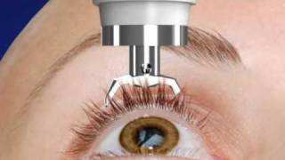 Unique DIATON Tonometry Through Eyelid  with Diaton Tonometer  Introduction  Description Part1 [upl. by Nonnerb]