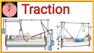 TractionDefinitionTypes of tractionIndicationsContraindicationsPrecautionsPurposeTraction [upl. by Etnauq]