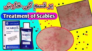 scabion forte lotion uses in urdu medicine [upl. by Napas]