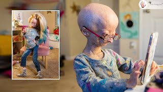 Adalia Rose Emotional Less Than 500 People in the World Have My Condition   Body Bizarre [upl. by Naic]