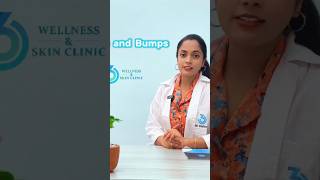 Lumps amp Bumps 360wellness drcherry lumps bumps youtubeshorts srilanka colombo [upl. by O'Reilly647]