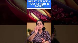 Heart attack  how patient is saved [upl. by Gilford]