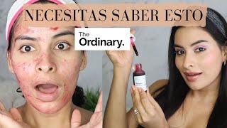 NECESITAS SABER ESTO SI VAS A USAR THE ORDINARY PEELING SOLUTION POR PRIMERA VEZ [upl. by Aicilanna]