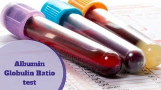 Albumin and Globulin AG Ratio [upl. by Loni425]