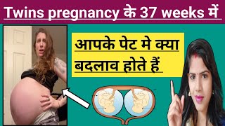 Twins pregnancy ke 37 weeks me pet me kya badlaw hote hai twins pregnancy ke 37 weeks me pet me dard [upl. by Halilak]