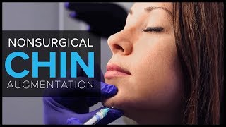 Non Surgical Chin Augmentation With Dermal Fillers at Mabrie Facial Institute [upl. by Anikram]