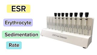 ESR Erythrocyte Sedimentation Rate Procedure laboratory medtechstudent cls mls hematology ESR [upl. by Etterrag209]