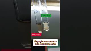 Tube coagulase test for Staphylococcus aureus staphylococcus tubecoagulase [upl. by Younglove]