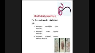 Parasitology  Schistosoma haematobium  by Dr Shimaa Nephrology Module [upl. by Remy543]