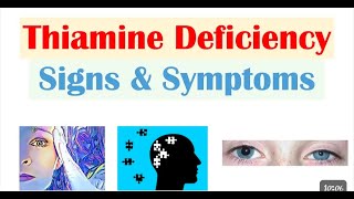 Vitamin B12 Deficiency Is adult and childs vitamineB12deficiency [upl. by Kushner]