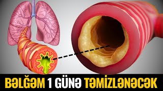 Boğazdakı Bəlğəm 1 Günə TƏMİZLƏNƏCƏK [upl. by Tai515]