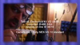 sE Electronics X1 XLR VS Neumann U87AI [upl. by Nebe]