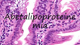 How to Pronounce Abetalipoproteinemia [upl. by Bernetta557]