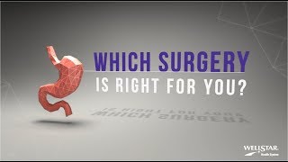 Wellstar Bariatric Surgery  Which Surgery is Right for You [upl. by Saisoj]