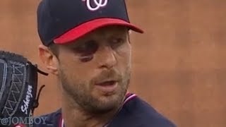 Max Scherzer strikes out ten batters with a broken nose a breakdown [upl. by Helfand]