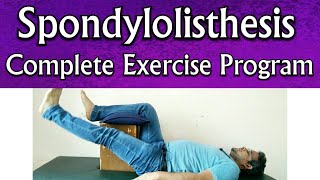 Spondylolisthesis EXERCISES  Effective Exercises For Spondylolisthesis TREATMENT At Home Naturally [upl. by Gittle]