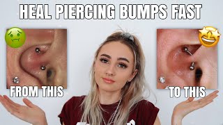 How to get rid of piercing bumps FAST 2021  Annie Jones [upl. by Refotsirk314]