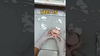 Uterus specimen grossing 🧐👀 [upl. by Nosraep]