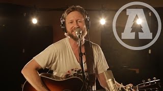 Cory Branan  Missing You Fierce  Audiotree Live [upl. by Ainyt]