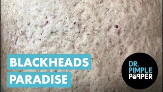 The Blackheads Paradise [upl. by Betsey]