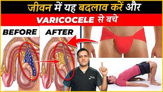 10 Lifestyle changes to stop growing varicocele  Dr Gaurav Gangwani Interventional Radiologist [upl. by Higginson]