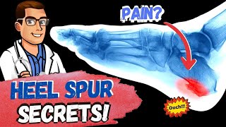 BEST Heel Spur Treatment Heel Spur Removal Stretches amp Massage [upl. by Keven]