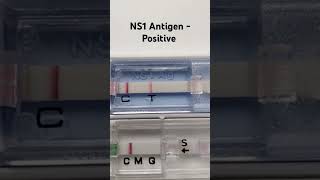 NS1 Antigen  Positive  Dengue test procedure  medicallaboratory shorts nursing [upl. by Hertberg]