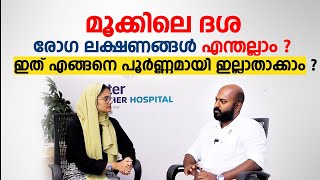 കുട്ടികളിലെ മൂക്കിൽ ദശ എങ്ങനെ പൂർണ്ണമായി ഇല്ലാതാക്കാം  Adenoids  Arogyam [upl. by Adnana725]