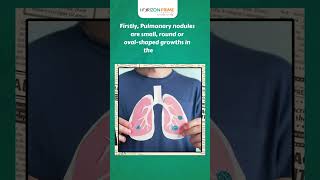 Understanding Pulmonary Nodules Causes Symptoms and More  Horizon Hospitals [upl. by Pavlish268]