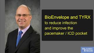 BioEnvelope and TYRX to reduce infection and improve the pacemaker  ICD pocket [upl. by Ggerk93]