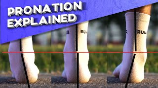 What is overpronation  Pronation types explained [upl. by Schifra159]