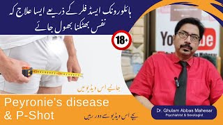 Peyronies disease and PShot With Hyaluronic Acid Filler  Dr Ghulam Abbas Mahessar  UrduHindi [upl. by Amik]