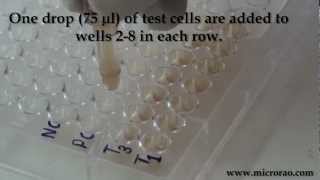 Treponema Pallidum Hemagglutination TPHA test for syphilis [upl. by Huei]