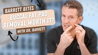 Should You Remove Your Buccal Fat Pads  Barrett Plastic Surgery [upl. by Luht]