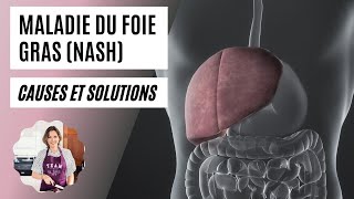 NASH  stéatose hépatique foie gras  causes et solutions [upl. by Acir85]