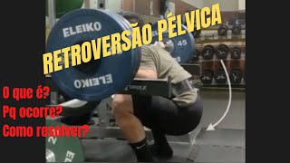 Retroversão Pélvica no Agachamento [upl. by Lleznod]