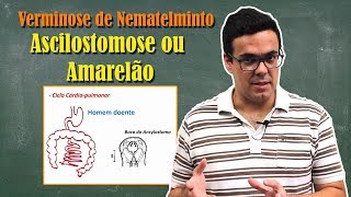 Ancilostomose Amarelão ou Doença do Jeca Tatu [upl. by Aural]