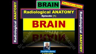 Radiological anatomy episode 1 BRAIN [upl. by Gitlow]