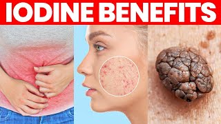 The Benefits of Iodine SideEffects and More [upl. by Iphigenia402]