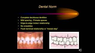 Interceptive Orthodontics CO2023 [upl. by Yalonda]