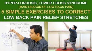 Hyperlordosis 5 Simple Exercises For lower back pain relief LOWER CROSS SYNDROME Pelvic Tilt [upl. by Mllly]